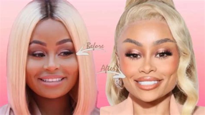Blac Chyna’s Before And After Transformation: Explained