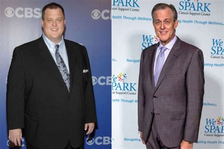 Is Billy Gardell Sick? Did He Undergo Bariatric Surgery? Details To Know