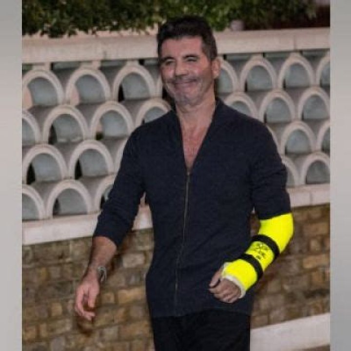 
Simon Cowell Had Another E-Bike Accident That Broke His Arm 