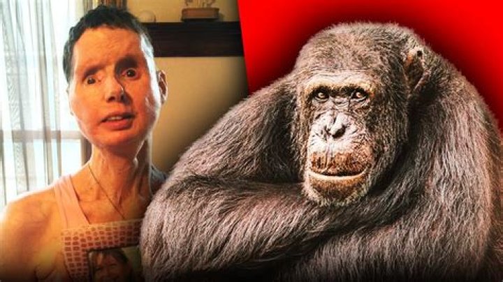 
What Happened To Charla Nash? Is Charla Nash Blind? 